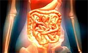 News Picture: Gut Microbes Differ in Obese or Diabetic People, Study Finds