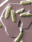 News Picture: Drug-Resistant Superbug Increasing in Southeast U.S. Hospitals
