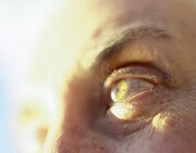 News Picture: Scientists Use Stem Cells to Grow Human Corneas in Mice