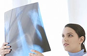 News Picture: Lung Infections May Hamper Ability to Detect Lung Cancer