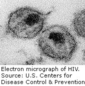 News Picture: HIV May Have Emerged in Congo in 1920s: Study
